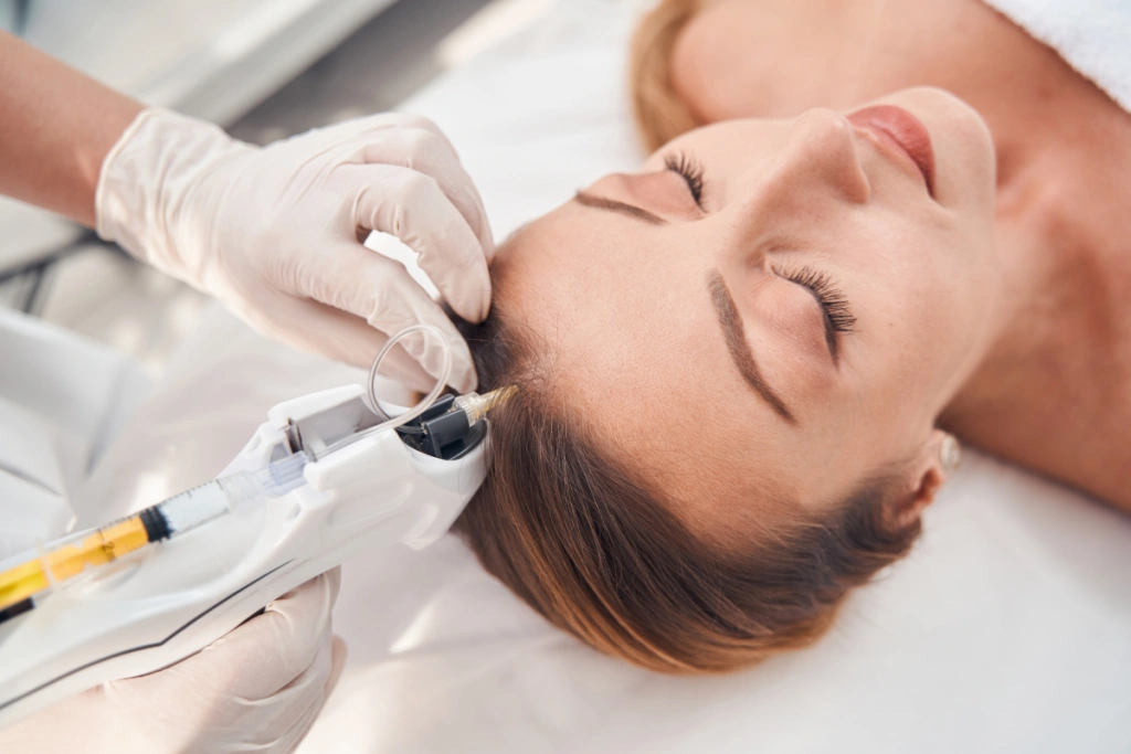 PRP treatment for hair loss being administered with a specialized injector for natural regrowth using Injectables.
